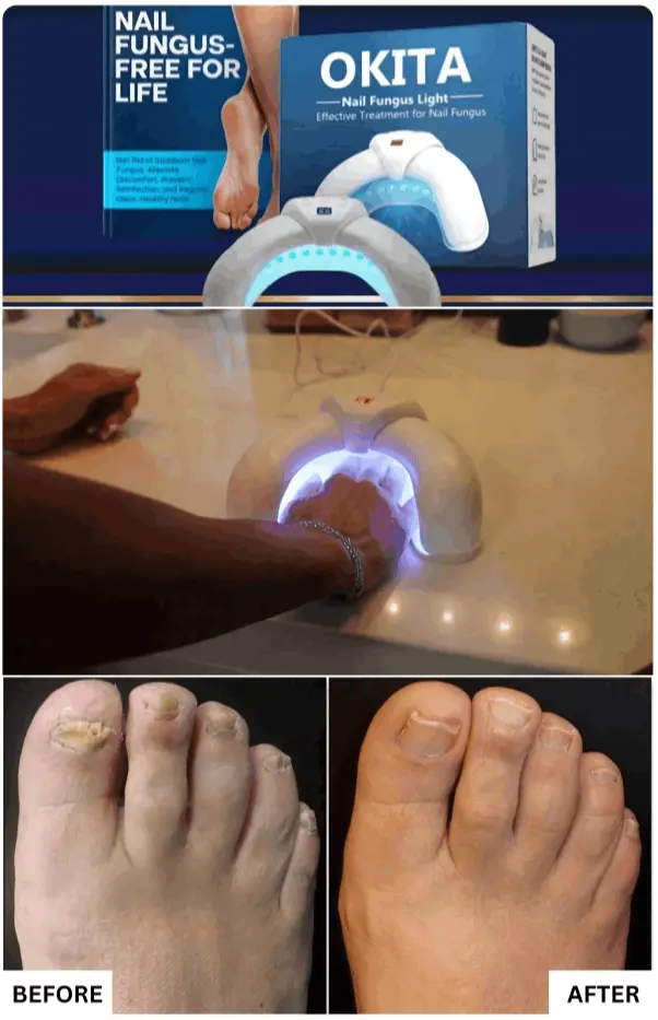 Okita Nail Fungus Lights